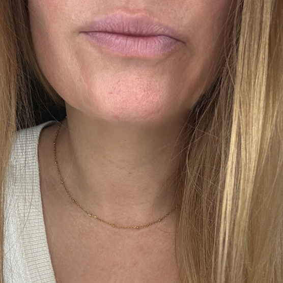 ROPE CHAIN CHOKER
